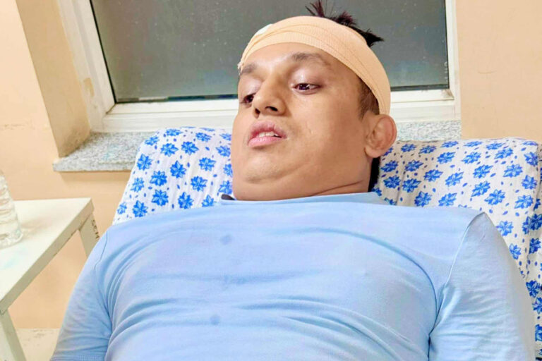 रास्वपा नेतामाथि कपनमा आक्रमण, टाउकोमा गम्भीर चोट
